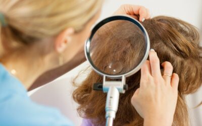 Wszawica u dorosłych? Nie ma w tym nic dziwnego